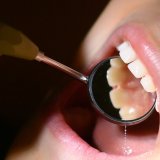 Les Suisses ont de bien meilleures dents qu'il y a 20 ans. KEYSTONE/DPA/JULIAN STRATENSCHULTE